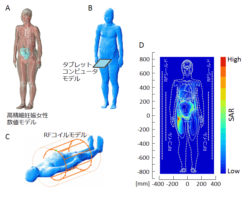 人体における電磁波エネルギー吸収量評価