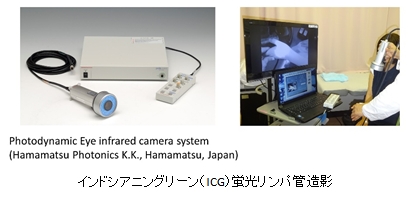リンパ管蛍光造影法