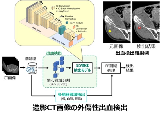 コンピュータ支援検出／診断(CAD)ソフトウェアの開発