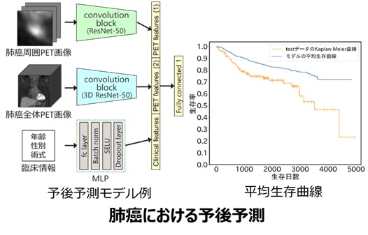 治療方針決定支援のための予測技術